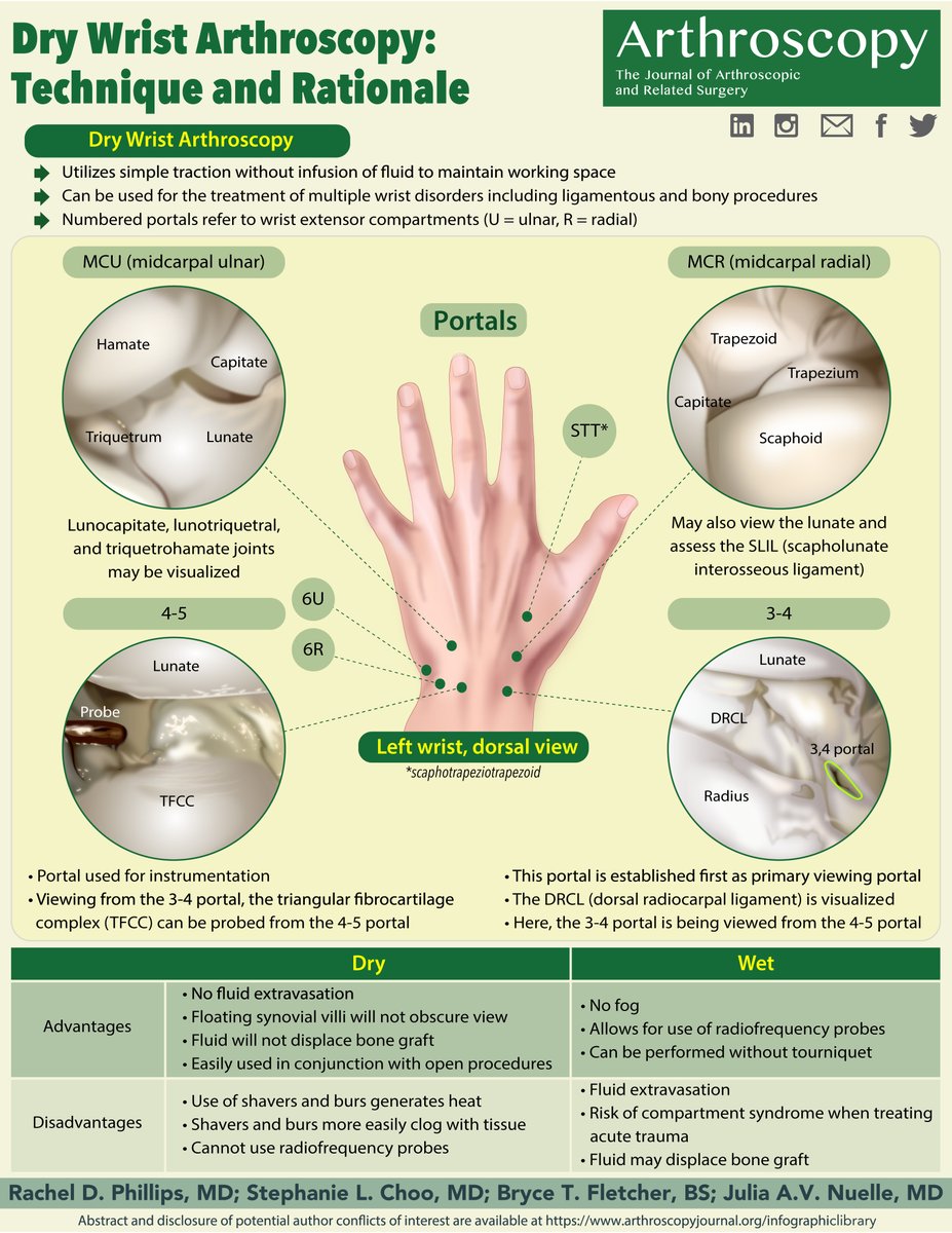 ArthroscopyJ's tweet photo. Dry Wrist Arthroscopy: Technique and Rationale - https://t.co/rClMOKVQJ7 @NuelleHandMD @MizzouOrthoRes https://t.co/Mpu7UyOknj