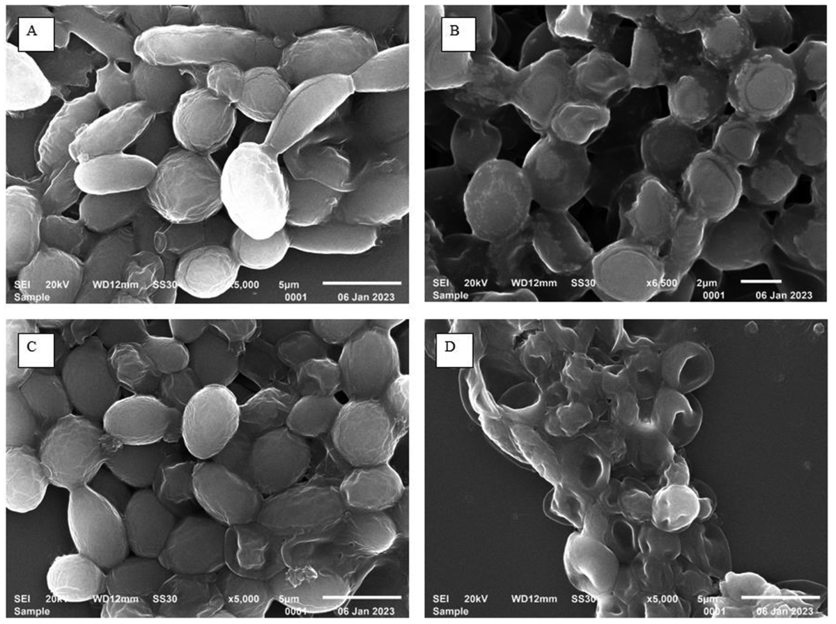 ESCMID Fungal Infection Study Group (EFISG) (@efisg_escmid) on Twitter photo Unusual fungemia outbreak in a NICU due to #Lodderomyces elongisporus in India
journals.asm.org/doi/10.1128/mb…
<a href="/AnuradhaMyco/">Anuradha Chowdhary</a> Unusual fungemia outbreak in a NICU due to #Lodderomyces elongisporus in India
journals.asm.org/doi/10.1128/mb…
<a href="/AnuradhaMyco/">Anuradha Chowdhary</a>
