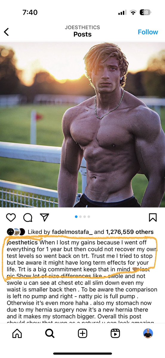 ted_ryce's tweet photo. Joesthetics, a popular bodybuilding star with 8 million IG followers, died at 30 from an aneurysm.

Although some are trying to pin this on c-19 vaccine, the fact is that he was using anabolic steroids/TRT.

He said some of his blood work was unusual after getting the vaccine and boosters.

Maybe the vaccines he took contributed to the aneurysm along with the steroids. 

I don’t know.

But the connection between steroid use, aneurysms, and premature death has been established long before 2020.

As stated in his IG below, he tried to stop but couldn’t recover his normal levels.

Young guys dying early with a history of anabolic steroid use is becoming more frequent.

Understand that going on using anabolic steroids/TRT comes with risk.

And that risk increases as your dose does.

He seemed like a great guy and my heart goes out to his family.

I respect him for sharing his story in detail so that we might learn something from it.