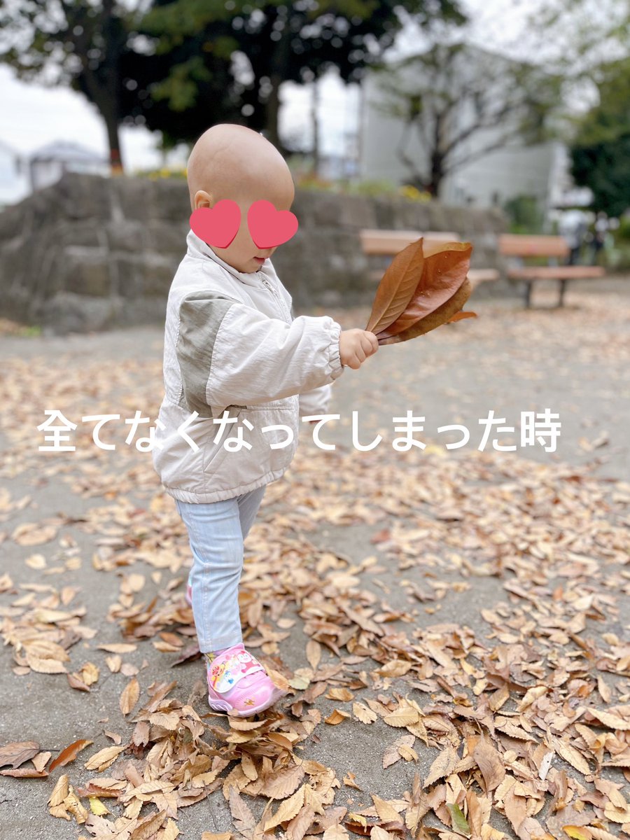 _____s2_12's tweet photo. Twitterの力を貸してください。現在3歳7ヶ月の娘は2歳2ヶ月頃から髪の毛が抜け始め次第に眉毛、まつ毛など毛は全て無くやっと産毛が生えてきました。診断としては円形脱毛症(全頭型)治療としては今は液体窒素＋塗り薬(フロジン、ステロイド)をしています。 https://t.co/QCggXmFfVg