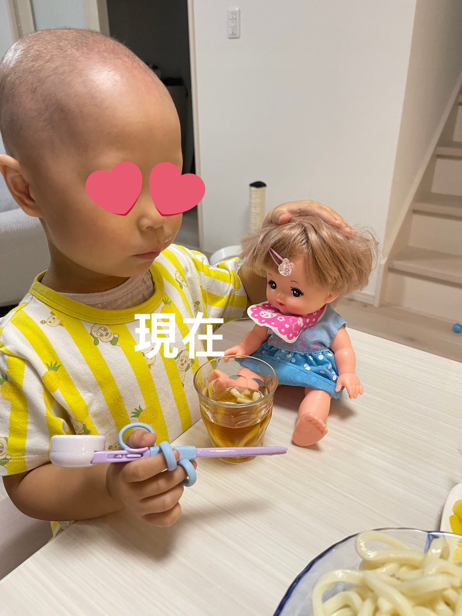 _____s2_12's tweet photo. Twitterの力を貸してください。現在3歳7ヶ月の娘は2歳2ヶ月頃から髪の毛が抜け始め次第に眉毛、まつ毛など毛は全て無くやっと産毛が生えてきました。診断としては円形脱毛症(全頭型)治療としては今は液体窒素＋塗り薬(フロジン、ステロイド)をしています。 https://t.co/QCggXmFfVg