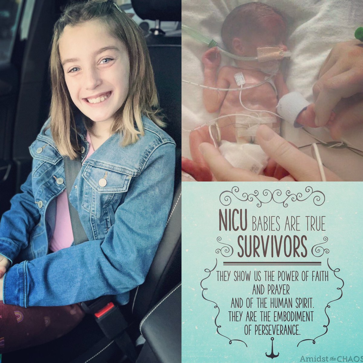 Born at 24 wks gestation, spent 183 days in Winnie Palmer NICU surrounded by glass, wires, oxygen & medical teams. With faith & prayer, Dakota battled to live showing the world her purpose & warrior spirit. Today my sweet miracle is 10!  #nicustrong #micropreemie #hellpssurvivors