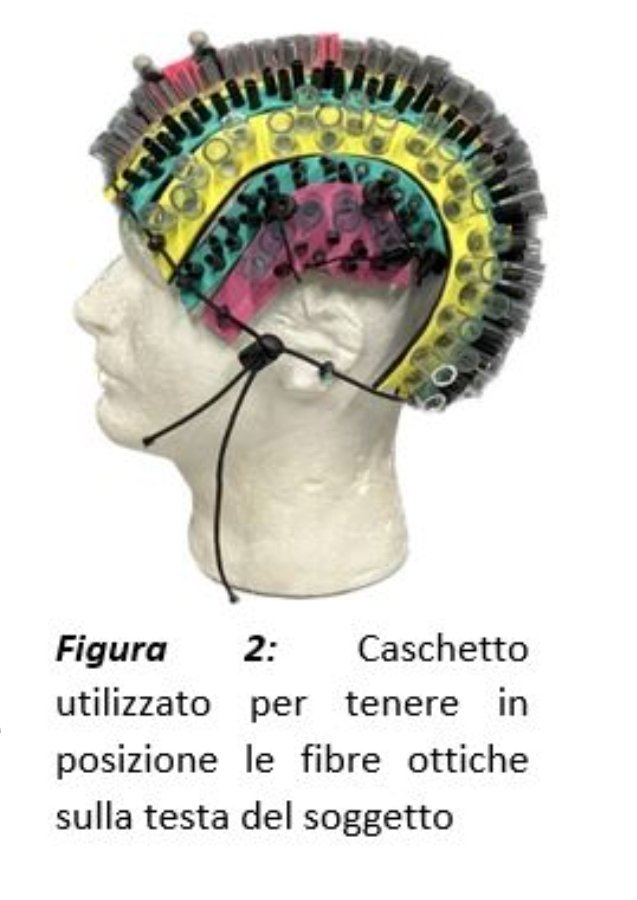 AssMoruzzi's tweet photo. Aiutaci a sostenere l'acquisto di un SISTEMA di STAMPA in 3D.
Partecipa al nostro crowdfunding.
Donando anche solo 5 euro ci aiuterai a fornire i laboratori di materiale plastico per la stampa del caschetto, utile nella ricerca neuroscientifica.
https://t.co/VCI4F9R3nc https://t.co/LXAQVwjaBu