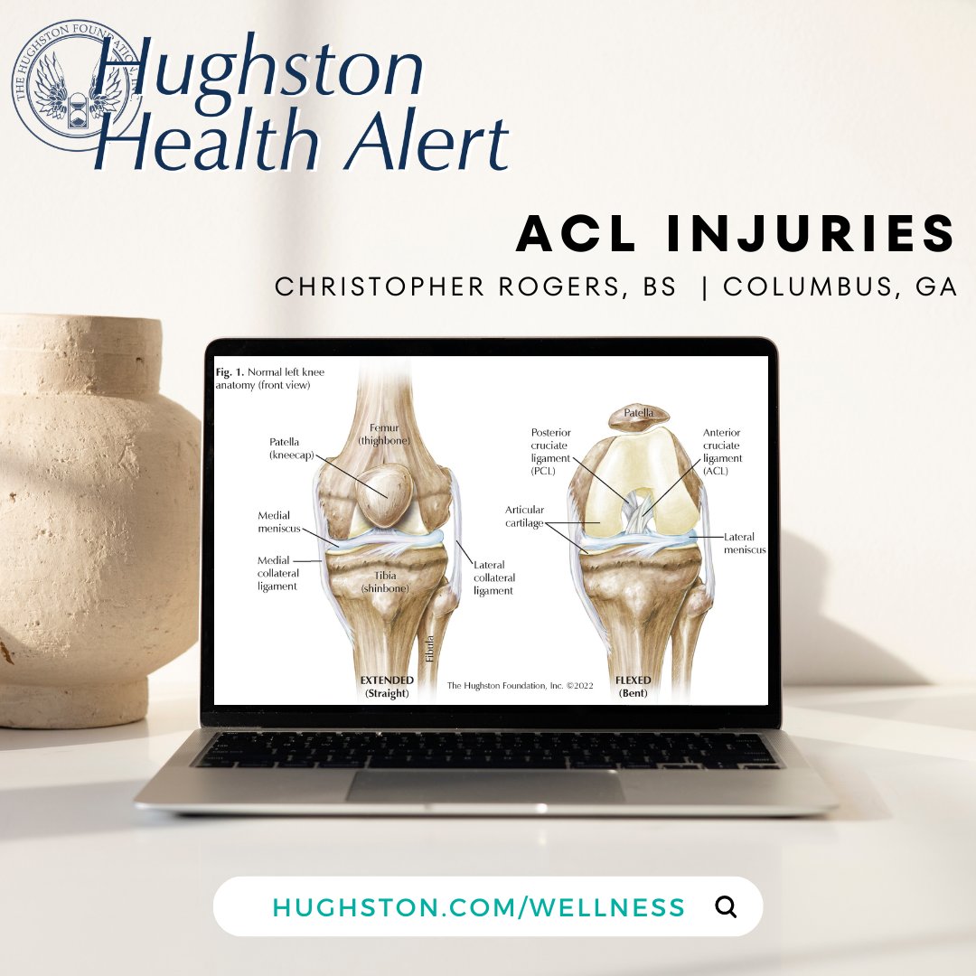 Hughston Health Alert |  ACL Injuries

Read the full article here: hughston.com/wellness/acl-i…

#health #healthcare #sportsmedicine #HCSM #bonehealth #aclinjuries