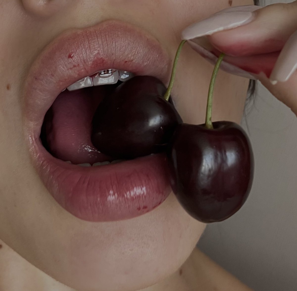 good evening🪽and that twitter began to work better? I don't have yet.

I am happy with the results of my orthodontist🦷
P.S. I had a diastema before.