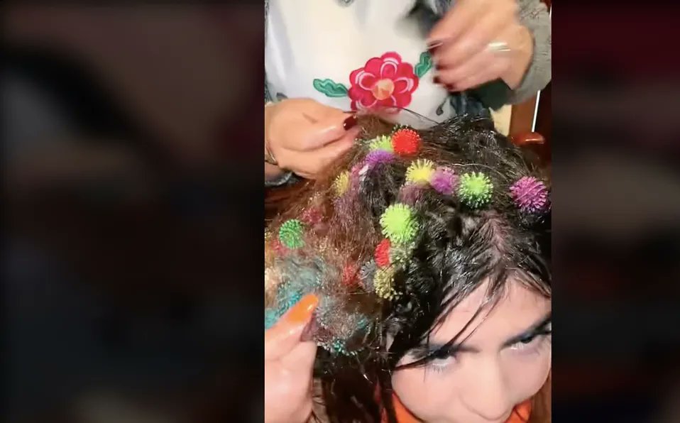telediariomty's tweet photo. VIDEO | Retiran 130 'bunchems' del CABELLO de una joven; tardaron más de 2 HORAS en quitarlos 

https://t.co/jrkzuqgk1e https://t.co/6llSIzWSXC