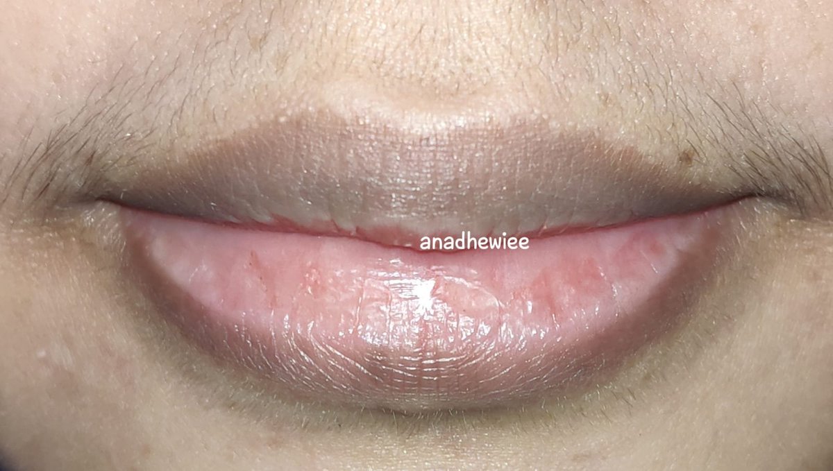 bynadna's tweet photo. siapa yg masih struggle sama bibir kering &amp; pecah2?

aku mau sharing gimana caranya dapetin bibir plumpy, anti kering &amp; lebih cerah kayak gini👌 https://t.co/LuRPyE8pg2