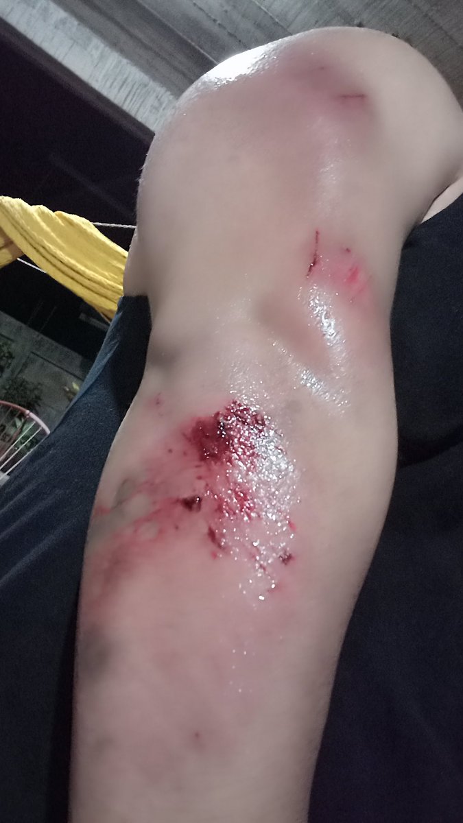 ElDaarky's tweet photo. Me cae de la bici :c https://t.co/OwJ5vqf62m