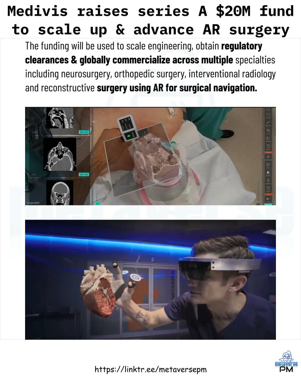 .@Medivis_AR raises series A $20M fund to scale up & advance AR surgery #metaverse #ar #vr #xr #augmentedreality #virtualreality #mixedreality #extendedreality #healthtech #hololens2 #neurosurgery #medtwitter #digitalhealth #medivis #surgery #hospital #medtech #surgicalar #ai