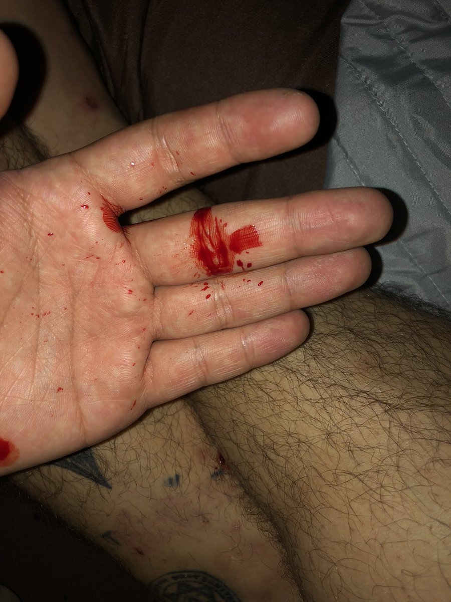 Ajajajja hoy tosí sangre en una cantidad considerable, el dia se acerca poco a poco