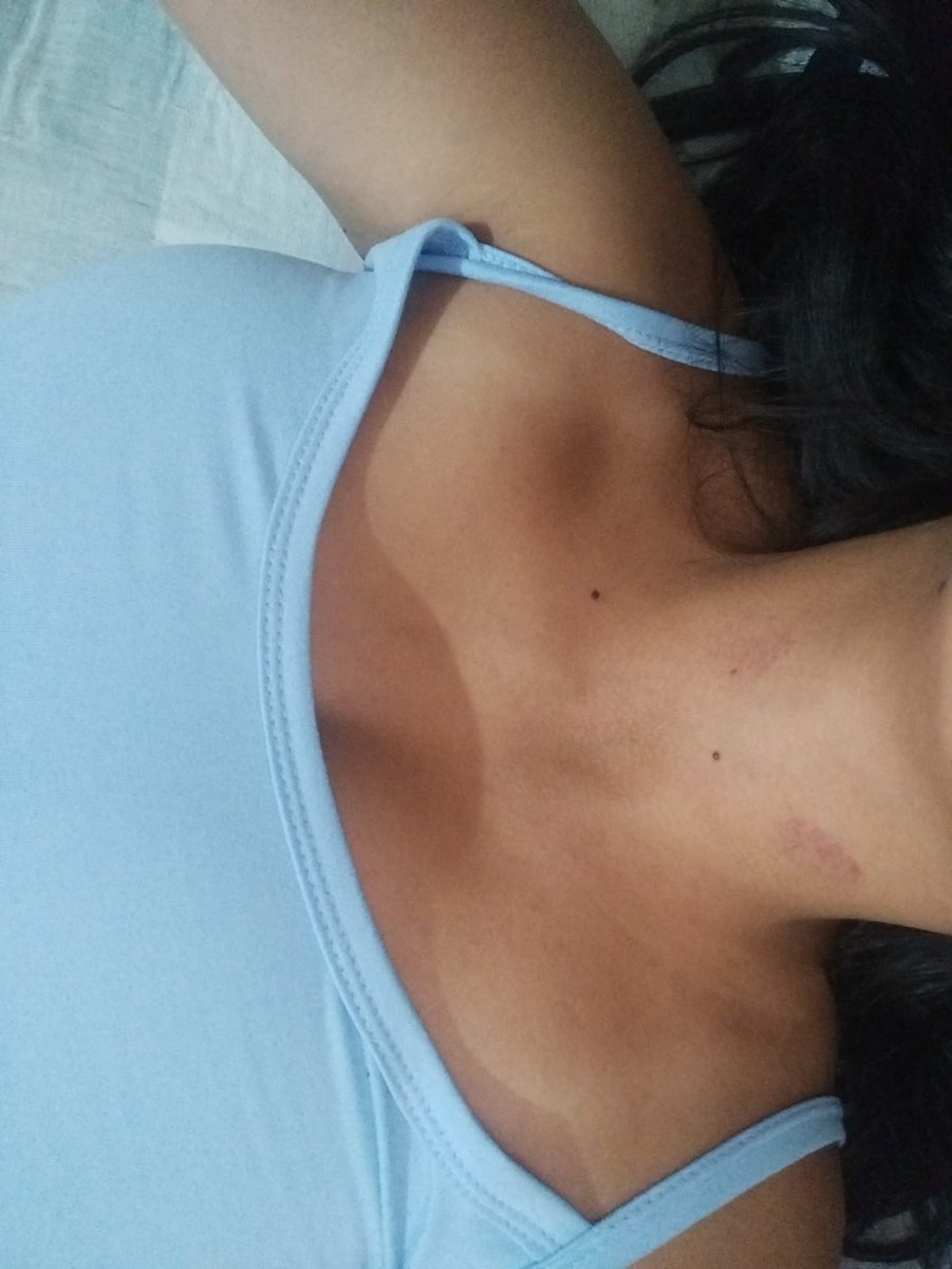 BDClientListMX2's tweet photo. EXTREMO CUIDADO!
Cuenta de TW reportada por estar tomado en el servicio, servicio sin condon, y en la denuncia de TW todavia se burla y dice que son gajes del oficio
NO ATENDER!
#AlertaDivas
Boletinado y reportado en nuestra pagina en grupos
@JavierD78179554 https://t.co/T7YMfeoLsu