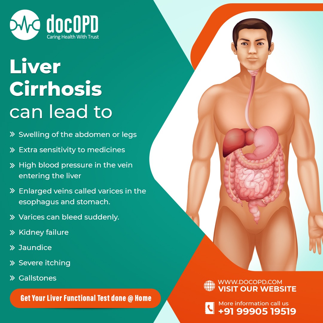 Get your liver functional test done @ home.
#liverhealth #liverfunction #LiverFunctionTest