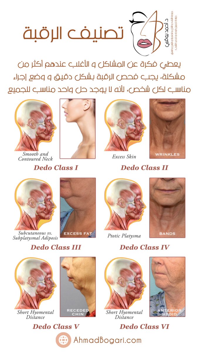AhmadBogari's tweet photo. تصنيف الرقبة: يعطي فكرة عن المشاكل و الأغلب عندهم أكثر من مشكلة، يجب فحص الرقبة بشكل دقيق و وضع إجراء مناسب لكل شخص، لأنه لا يوجد حل واحد مناسب للجميع.

#تجميل #تجميل_الوجه #شد_الرقبة #لغلوغ #تحديد_الفك #شيخوخة_البشرة #شيخوخه #جراحة_تجميل #نضارة #تجاعيد #السعودية https://t.co/tlU56dMrKR