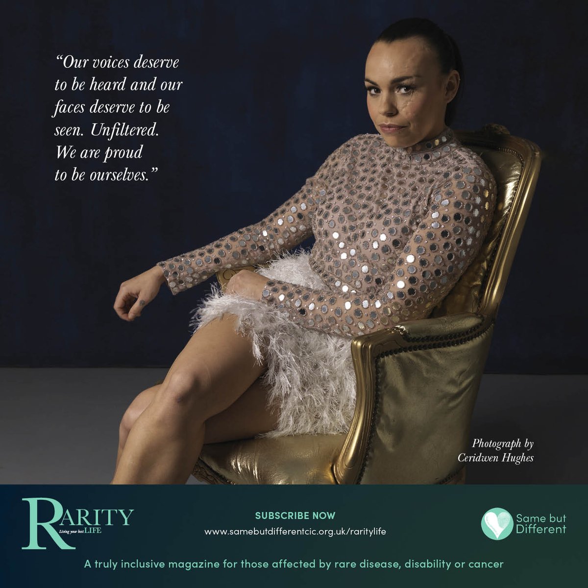SBDRareProject's tweet photo. In our style feature Phyllida, CEO of @FaceEqualityInt, is our beautiful swan who has found her voice.
Info: Dress bought from @ASOS & makeup by @laurawisinger
Visit #RarityLife below:
https://t.co/JFMRlap4KQ
#RarityLife #FacialEquality #RareTales #Style #nationallottery https://t.co/gsdSxMMAm5