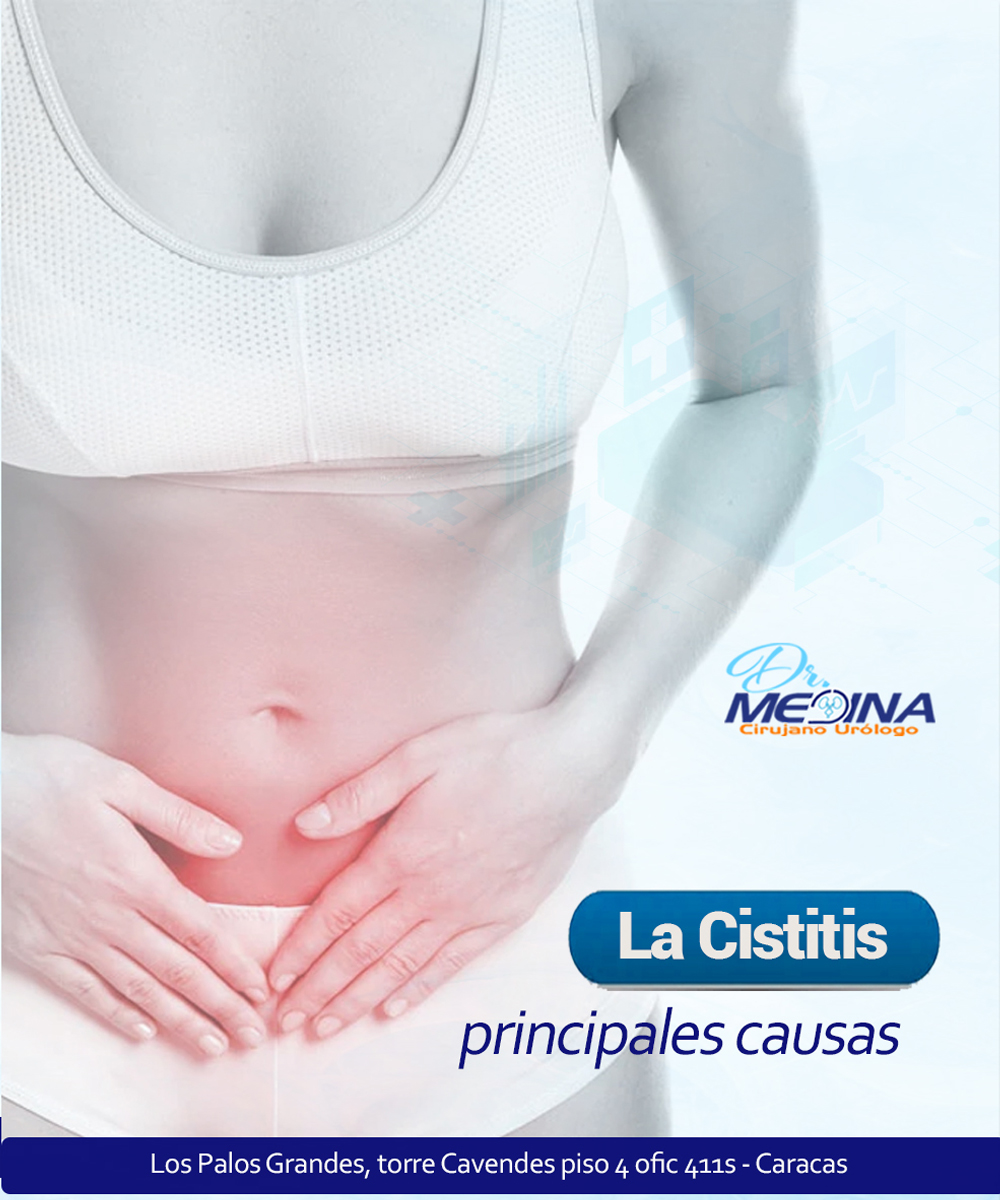 uroprotesis's tweet photo. La cistitis puede manifestarse como una reacción a ciertos medicamentos o a la radioterapia.Asimismo, los factores que pueden irritar la vejiga, como los productos de higiene íntima, los geles espermicidas o el uso prolongado de una sonda, también pueden provocar cistitis. ⁣ https://t.co/mtp7Ev2Uc5