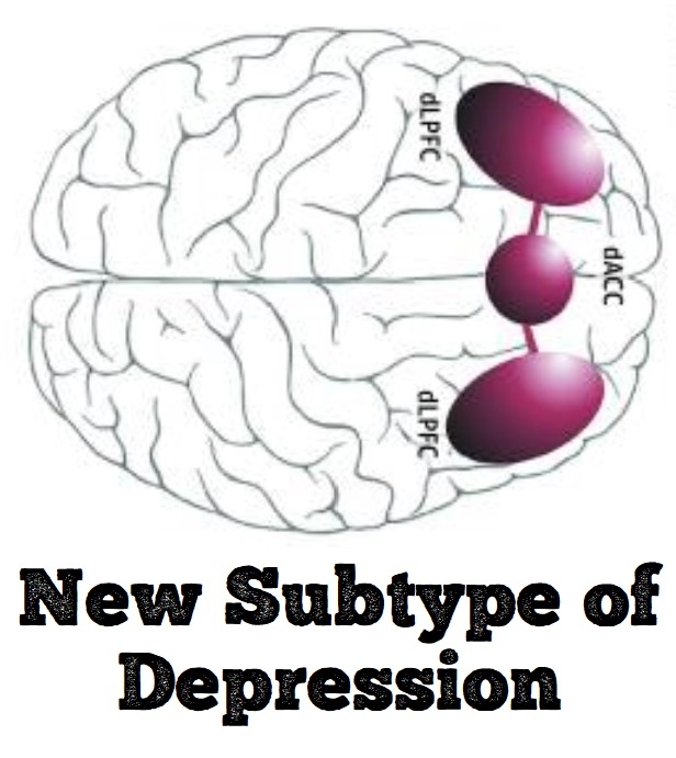 CarlatPsych's tweet photo. New “cognitive” #depression proposed with 1) Slow processing 2) Insomnia 3) Low functioning 4) Impairments in cognitive control circuits on fMRI. It had poorer response to antidepressants in this trial:
https://t.co/0n8sYJcI9y

They are exploring guanfacine &amp; TMS -@ChrisAikenMD https://t.co/ElcwT0K1Ba