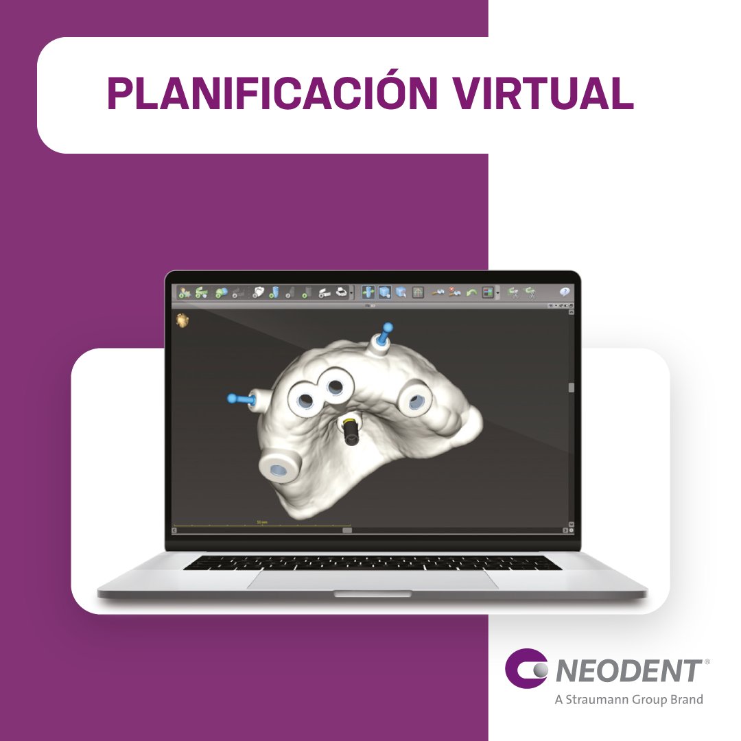 NeodentES's tweet image. Simplicidad desde la adquisición de datos hasta la cirugía.

Neodent® EasyGuide te otorga una gran pedictibilidad para obtener resultados seguros y que cumplan las expectativas de tus pacientes. ¡Descubre el proceso! ⬇👀

#Neodent #implantologia #easyguide #cirugiaoral