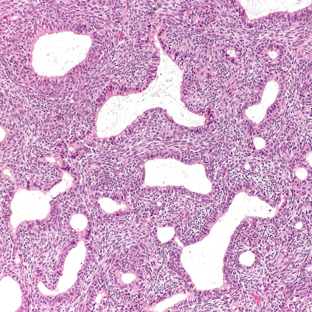 IRCCS_Rizzoli's tweet photo. Luglio, mese dei #sarcomi – tumori rari, difficili da diagnosticare. @IRCCS_Rizzoli è hub di riferimento specialistico per queste neoplasie, da decenni all’avanguardia nella ricerca e nella cura dei sarcomi dell’osso e dei tessuti molli https://t.co/Ckfz3NZmr1