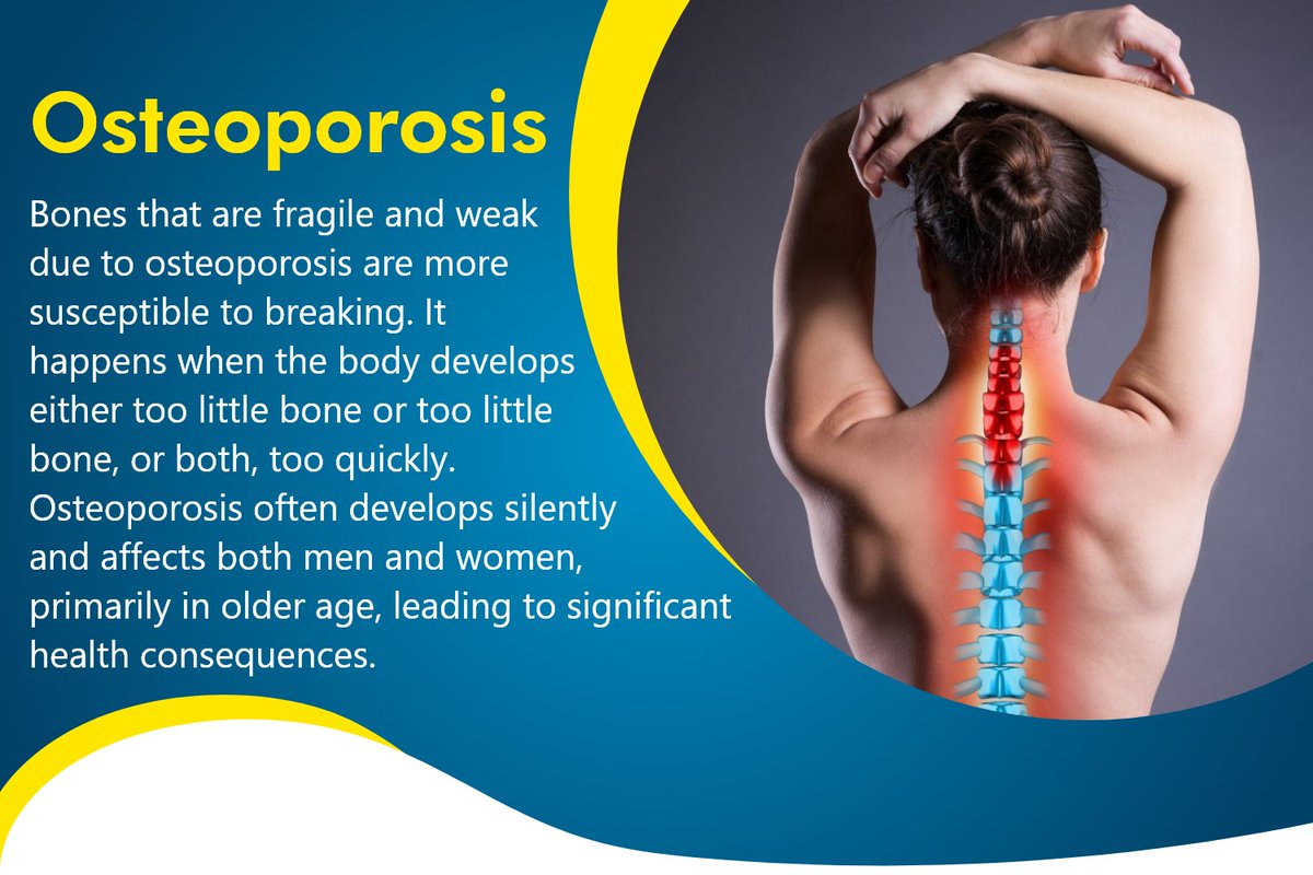 Osteoporosis develops when more bone is broken down than replaced.
#Osteoporosis #WellnessCommunity #KnowYourHealth #DiseaseFree #HealthIsWealth #SupportAndPrevention #HealthyHabitsForLife #StaySafe #DiseaseControlProgram #HealthEducationMatters 
umbrellamd.com