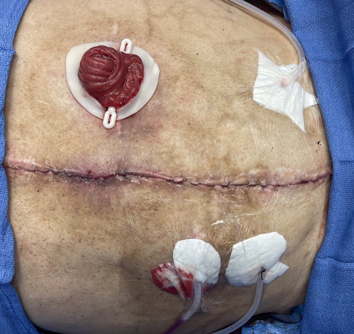 Dr Feza Remzi tweet media