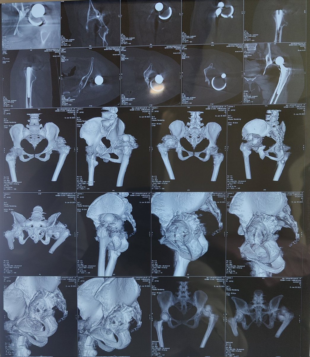 Dr Balamurugan J 🇮🇳 tweet media