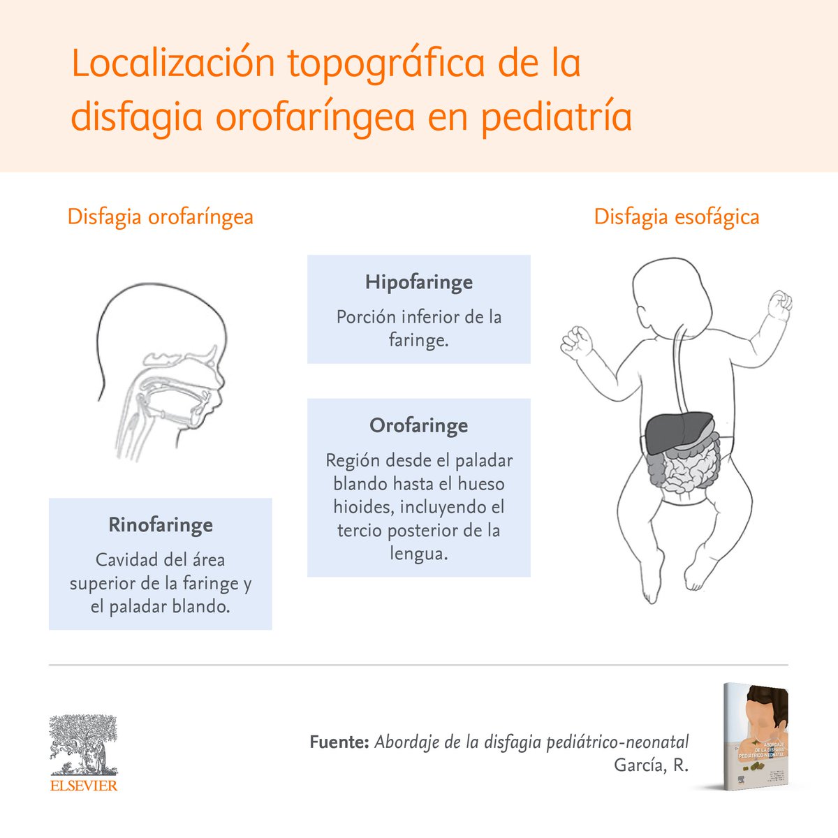 🔶 Abordaje de la #disfagia pediátrico-neonatal 

👉  spkl.io/60144gCip