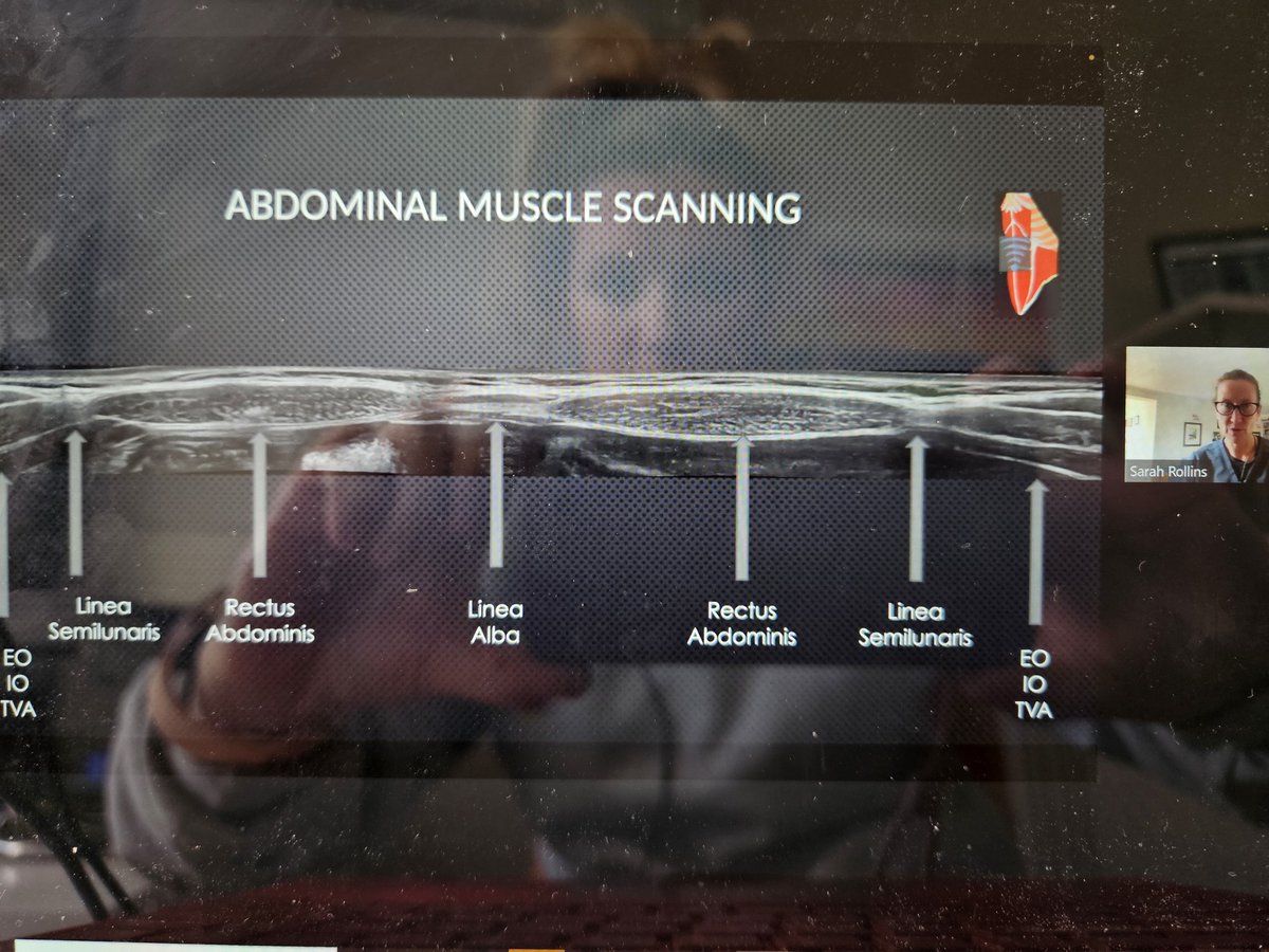 Webinar 2 with <a href="/DrSarahRollins/">Dr Sarah Rollins</a> is underway. She is talking all things #diastasis. This is free to access for all our <a href="/athleticFE_male/">theathleticfemale</a> members or pay to view if not. #theathleticfemale #femaleathlete #TAFFE