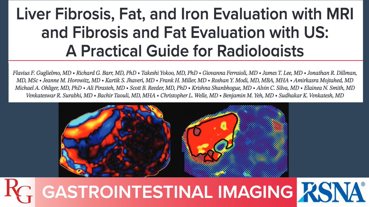 Sarah Bastawrous, DO (@sbastawrous1) on Twitter photo Quantitative liver imaging is an emerging tool in management of liver disease. Let’s review basics of quantifying liver fibrosis, fat & iron with MRI & US with this practical guide by Flavius Guglielmo <a href="/FGuglielmoMD/">Flavius Guglielmo, MD</a> & team! 👉 bit.ly/46o8qrt
#RGphx @Radiographics Quantitative liver imaging is an emerging tool in management of liver disease. Let’s review basics of quantifying liver fibrosis, fat & iron with MRI & US with this practical guide by Flavius Guglielmo <a href="/FGuglielmoMD/">Flavius Guglielmo, MD</a> & team! 👉 bit.ly/46o8qrt
#RGphx @Radiographics