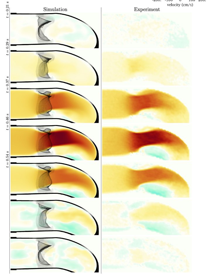 Just out from our lab in <a href="/ABMEjournal/">ABME</a>! Comparison of pulmonary valve dynamics in immersed boundary simulations vs. 4D flow MRI.  Joint work with Eaton Lab <a href="/StanfordEng/">Stanford Engineering</a>  Nice job Alex and Nicole! rdcu.be/dfCEe