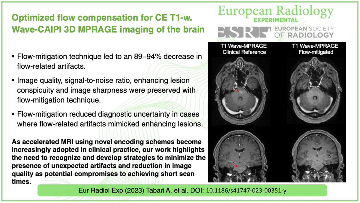 Azadeh Tabari (@azitabari) on Twitter photo We've developed an optimized Wave MPRAGE protocol to mitigate the flow-related artifacts that can mimic enhancing lesions of the brain.
Thanks to <a href="/MinLangMD/">Min Lang</a> <a href="/SusieHuangMDPhD/">Susie Huang</a> <a href="/drjohnconklin/">John Conklin</a>
secure-web.cisco.com/1wnaHj1PQkKVDD…
funfact:🍍juice was used as MR contrast agent in the phantom We've developed an optimized Wave MPRAGE protocol to mitigate the flow-related artifacts that can mimic enhancing lesions of the brain.
Thanks to <a href="/MinLangMD/">Min Lang</a> <a href="/SusieHuangMDPhD/">Susie Huang</a> <a href="/drjohnconklin/">John Conklin</a>
secure-web.cisco.com/1wnaHj1PQkKVDD…
funfact:🍍juice was used as MR contrast agent in the phantom