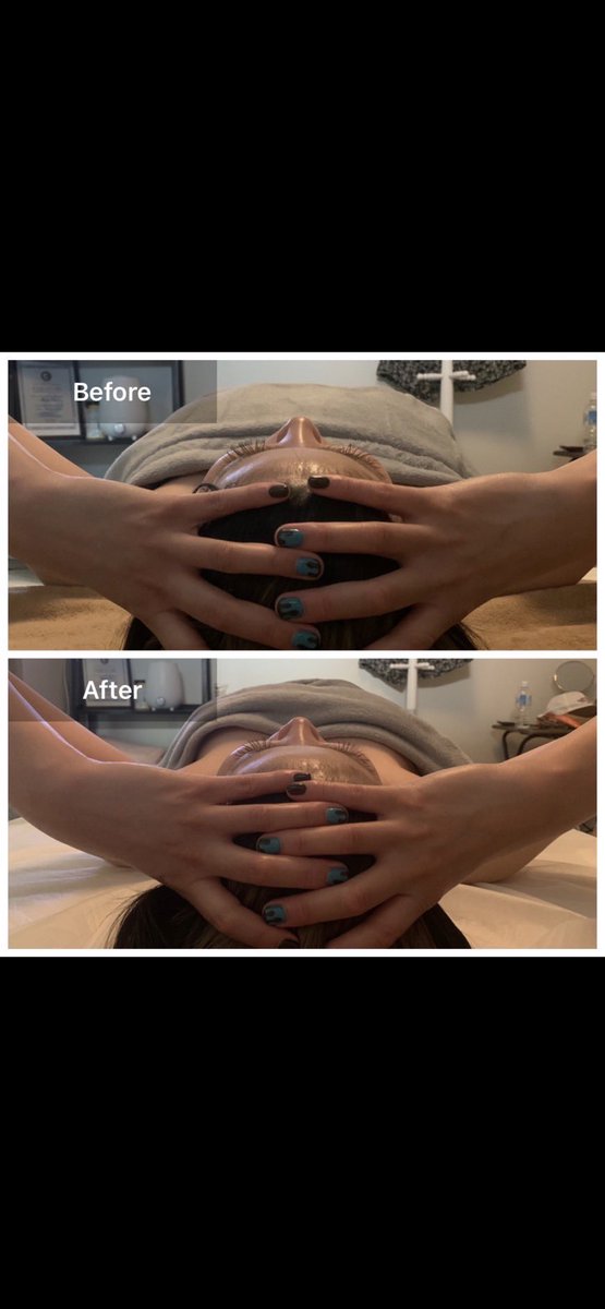 Parafusemasayo's tweet photo. before after 💆‍♀️
頭の浮腫が取れスッキリ✨✨
施術後の
「頭が軽くなった」
「頭の浮腫って分からなかったけど浮腫取れたのが分かる」
「朝「施術の次の日」スッキリ起きれた」
感想たくさん頂いております😆
#高知
#高知市
#脳洗浄
#自宅サロン
#リラクゼーションサロン https://t.co/jeCC2ns59a