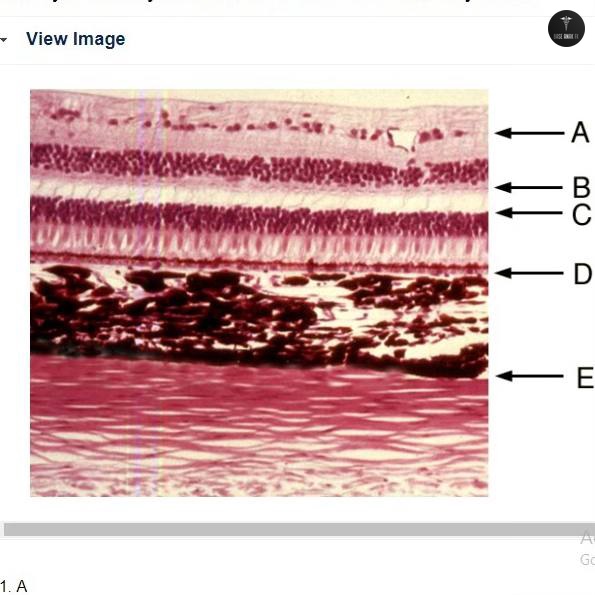 BaseAnakFK's tweet image. dok! ada yg bisa bantu nama lapisannya ga ya? makasih