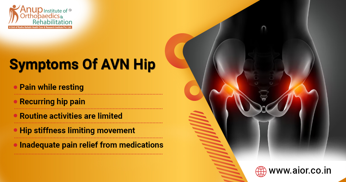 Symptoms Of AVN Hip 

#avascularnecrosis #osteonecrosis #hiposteonecrosis #avascularnecrosistreatment #avn #hipavascularnecrosis #besttreatment #patnadoctor #bihar #hippain