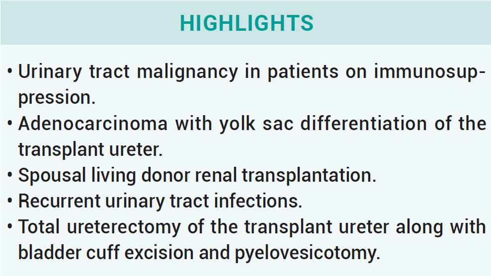 KJT_Journal's tweet photo. #Case
Primary adenocarcinoma with yolk sac differentiation in the transplant ureter and salvage of the transplant kidney
 
Download PDF 👇
https://t.co/MXUilvtoBN

#OpenAccess #FOAMed #MedTwitter #SciTwitter #TransplantTwitter #KidneyTwitter #livertwitter https://t.co/nsTTXoTWUg