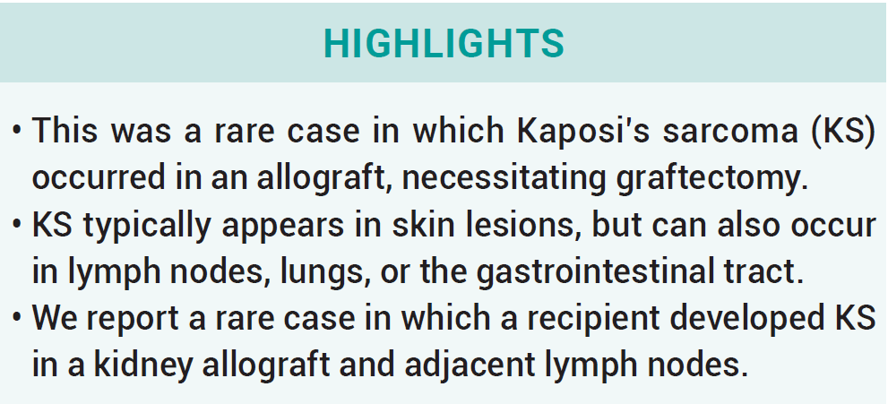 KJT_Journal's tweet photo. #Case
Transplant-associated Kaposi’s sarcoma in a kidney allograft
 
Download PDF 👇
https://t.co/elIV74g8b0

#OpenAccess #FOAMed #MedTwitter #SciTwitter #TransplantTwitter #KidneyTwitter #livertwitter https://t.co/jZLxw1Yi63