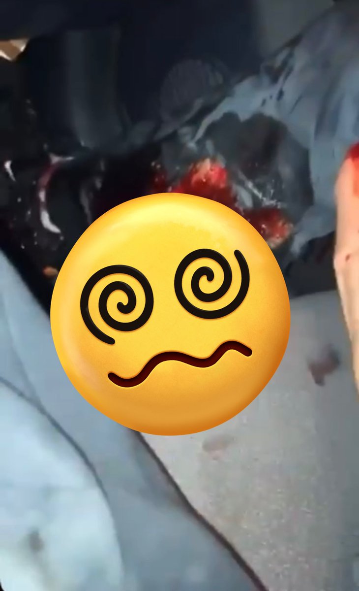 UnePasDeuxFR's tweet photo. Il lui manque un bout de jambe non ? 🧐

#Emeute 

Vidéo ici ⬇️

https://t.co/O1LpDLd64C https://t.co/PsHWQBsyed