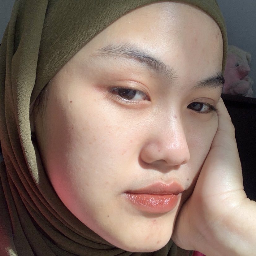 sundakentel's tweet photo. ⋆.✧̣̇˚ cara aku menghilangkan bekas jerawat ⋆.✧̣̇˚

contains : 
— Tips 
— Rekomendasi produk 

#skincareroutine https://t.co/vl2Y1ZYv97