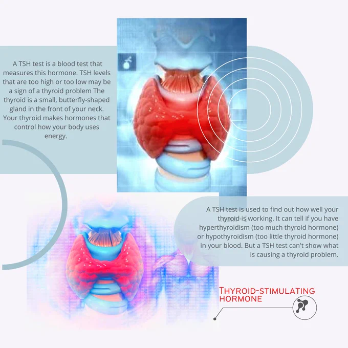 andrewjohnpub1's tweet image. A #TSHtest is a blood test that measures the Thyroid Stimulating #hormones .TSH levels that are too high or too low can indicate that your thyroid isn't working correctly. The test can help diagnose a variety of thyroid conditions. 

#viral #Trending #healthcare #oriele