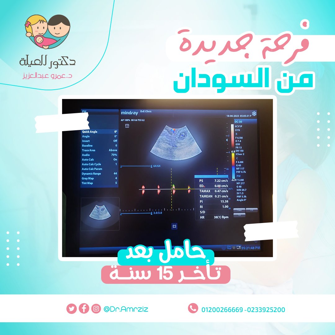 DrAmrAziz's tweet photo. وتتوالي الأخبار السعيدة

لسيدة من السودان عمرها 38 سنة
مخزون مبيضي ضعيف جدا 0.09
تم عمل حقن بلازما للمبيض لتحسين جودة البويضات
بعدها بدأنا برنامج الحقن المجهري
الحمد لله اليوم حامل في الاسبوع السادس
بعد 15سنة من تأخر الانجاب

#حقن_مجهري #اطفال_الانابيب #نساء_وولادة #حمل #السودان https://t.co/L1705F38r7