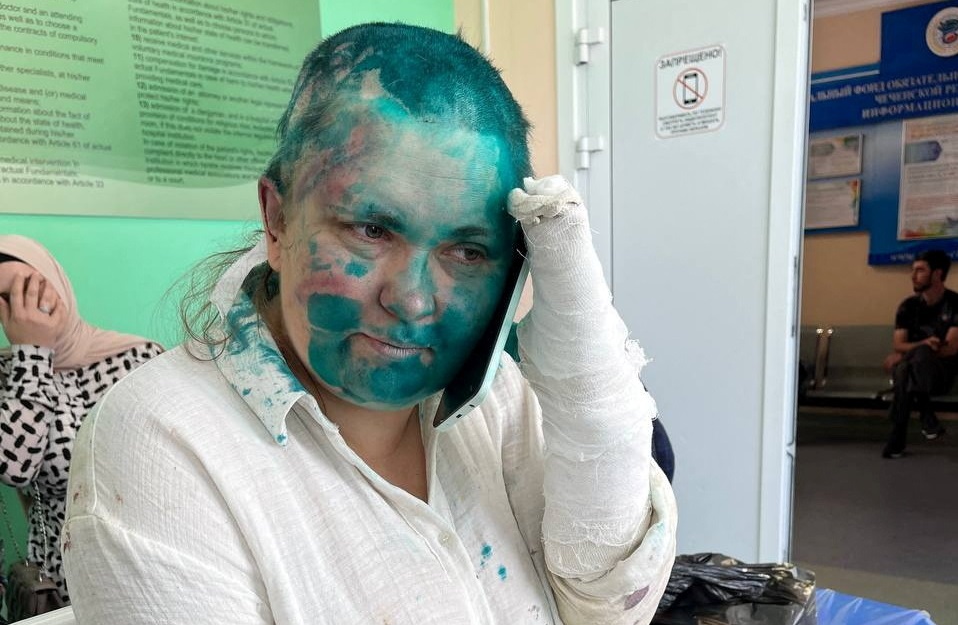 Agressió brutal contra la periodista d'investigació russa Ielena Milaixina, crítica amb Putin ccma.cat/324/agressio-b…