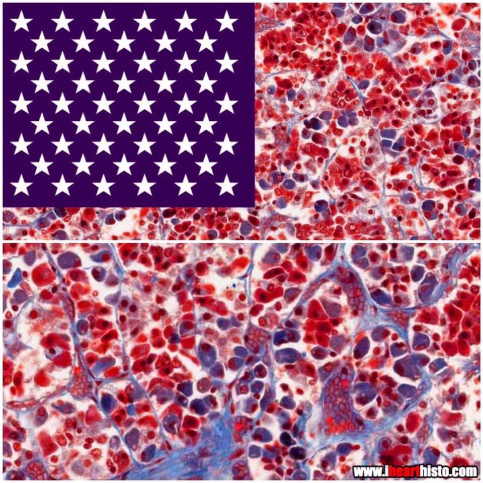 🇺🇸 Patriotic Pituitary 🇺🇸

There's a little Red (acidophils) White (chromophobes) &amp; Blue (basophils) inside all of us!

This image shows the anterior pituitary aka the adenohypophysis.

Happy 4th of July everyone!

🇺🇸

#histology #anatomy #pathology #FourthofJuly