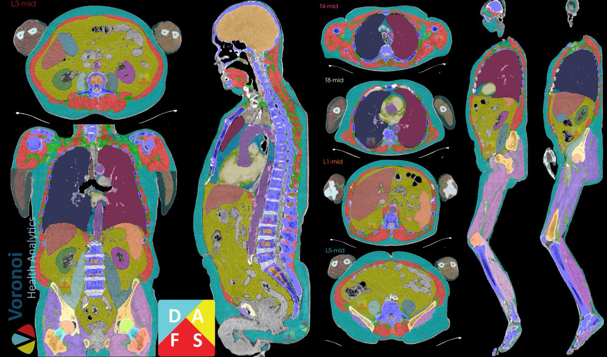 Mirza Faisal Beg, Ph.D., P.Eng tweet media