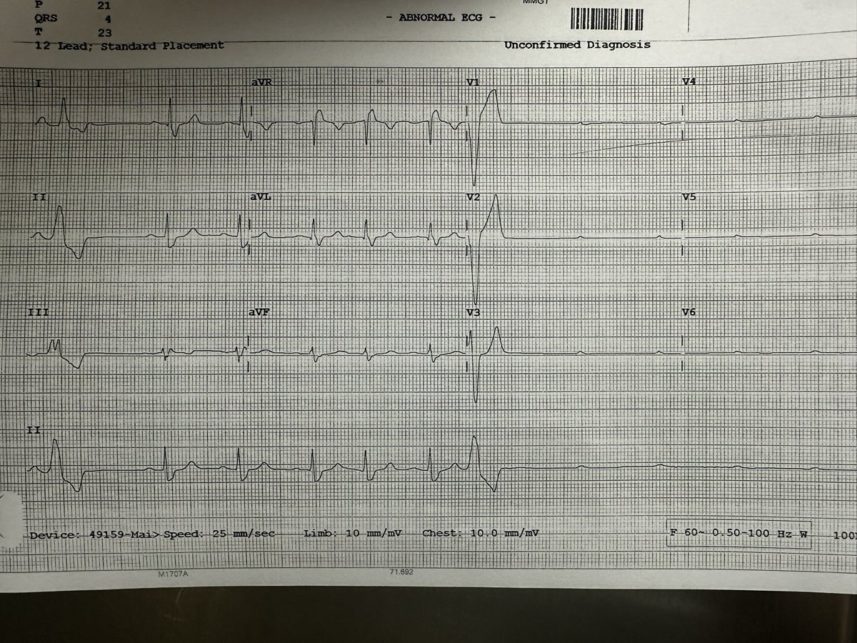 @Hapa_EP @EF_Cardiaca @EP_Leiden @FYang_EP @epTicTocDoc @Ablationist @netta_doc @DoctorPhillEP @narrowQRS @UlhasDr @ESTIMULACIONyA1 @CHRS_SCR @BiotronikES @ArritmiasHMar @Arritmias_SEMES @blogarritmias @ritmo_SEC @ResiSec @Arritmias_HRC @ArritmiasNegrin @CarinaHardy4 @syamkumarmd