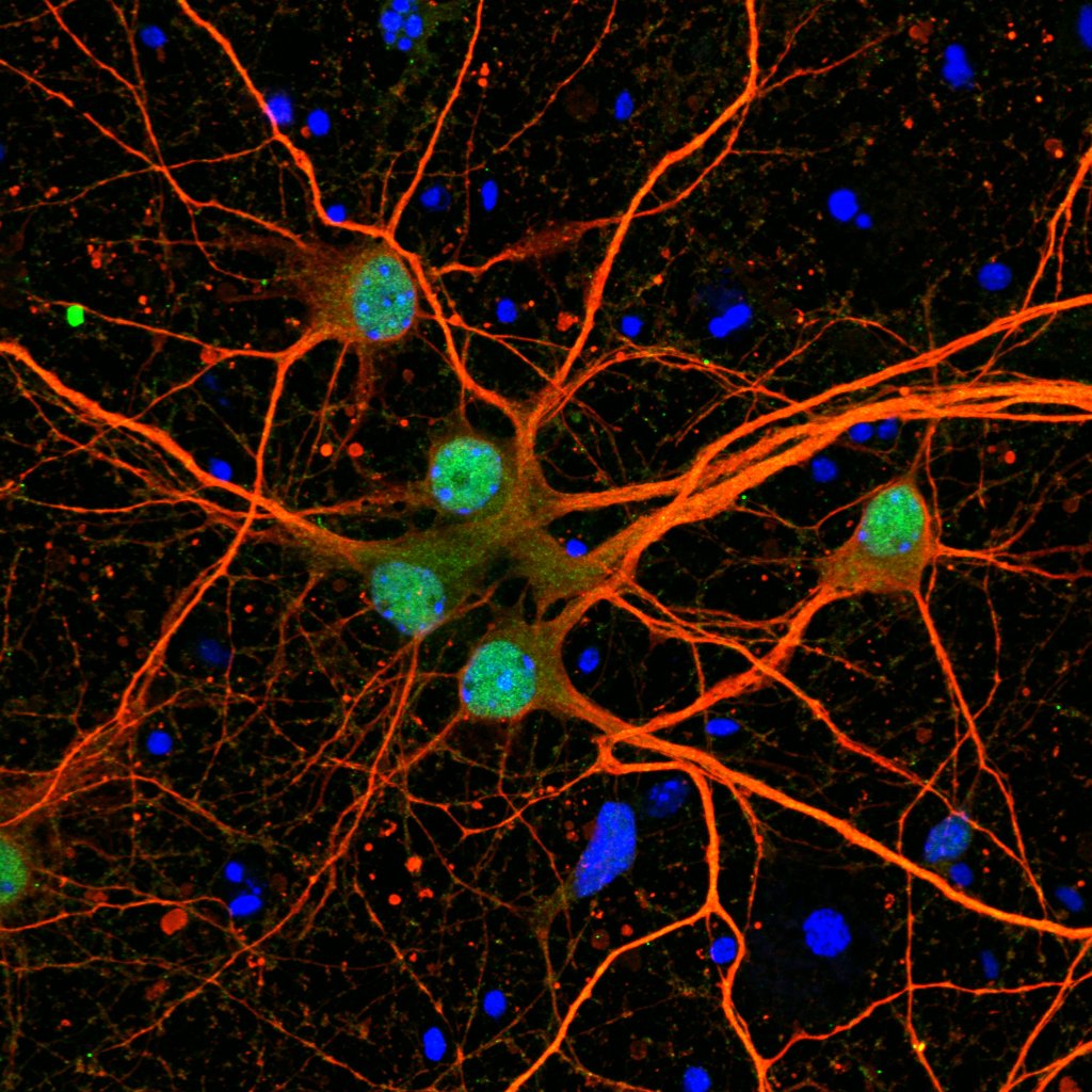 Exciting Wellcome Trust-funded postdoc positions available in our lab to understand how #signalling is disrupted in #intellectualdisability. Come join us and learn cool methods in #massspectrometry and #stemcell biology. Apply here by 31st August;
dundee.t1cloud.com/T1Default/CiAn…