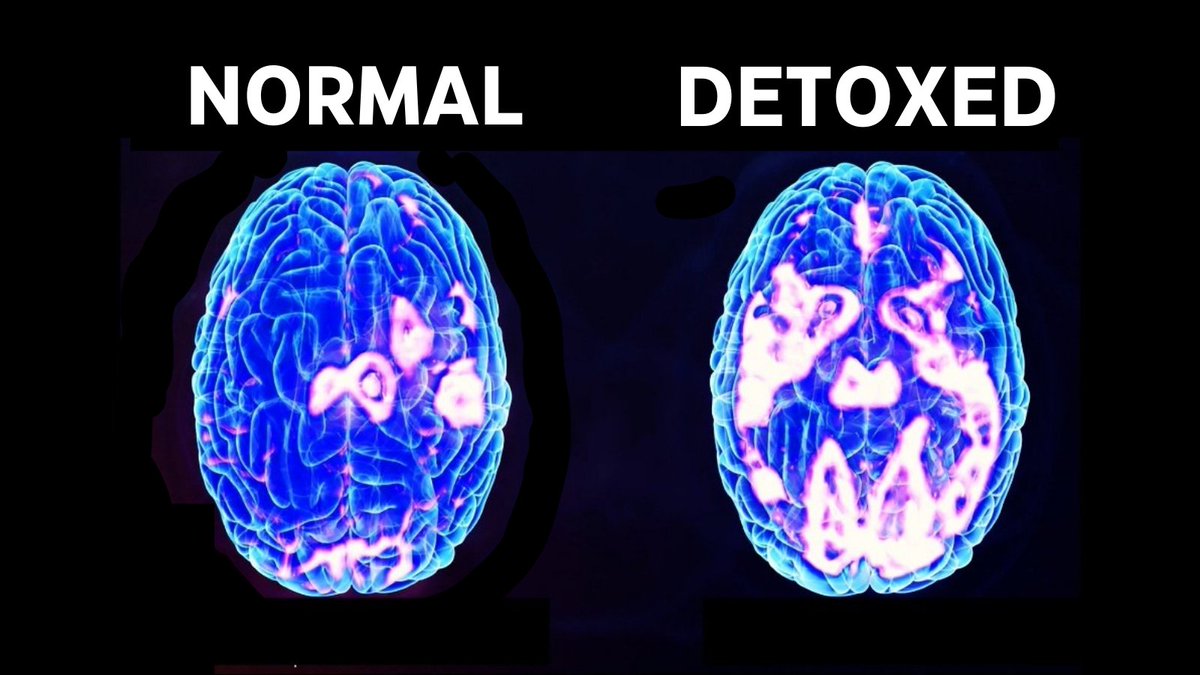 danmurrays's tweet image. You Might Need To Detox Your Brain

Here's why: