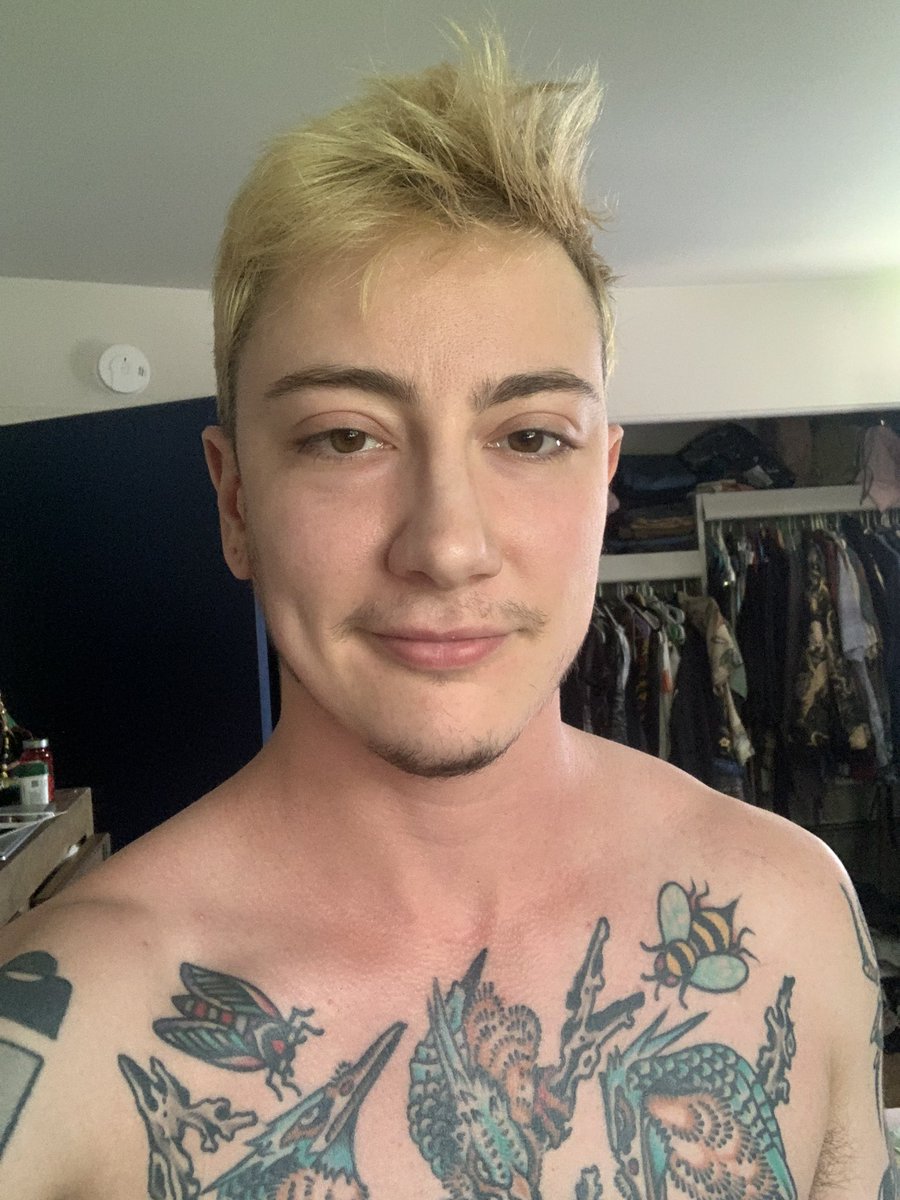 zebrewy's tweet photo. All one year apart! Just had my uterus removed yesterday so not in my hottest form but had to keep the trend going https://t.co/SLfVaUgzlD
