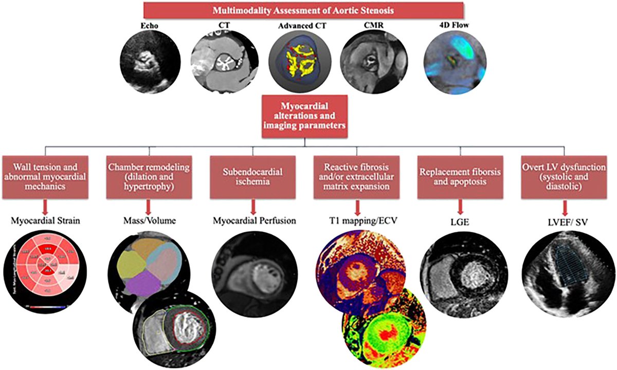 Multimodality Imaging in Aortic Stenosis: Beyond the Valve - Focusing on the Myocardium @sgaznabi @JeirymMirandaMD @danilorenzatti @pamelapina_s @AndreaScotti21 @CarlosGongoraMD @EdwinHoMD @aschenonegiugni @azeemlatib @purviparwani authors.elsevier.com/a/1hMXw5WqPxIi…