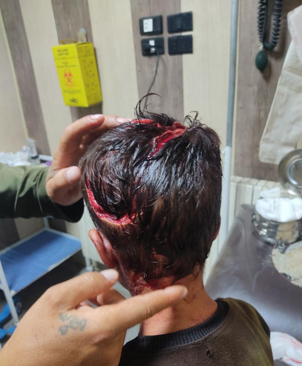 timtams83's tweet photo. Young boys was attacked by a dog in the village of #Filun, south of #Idlib. https://t.co/SIRUMTkTqE