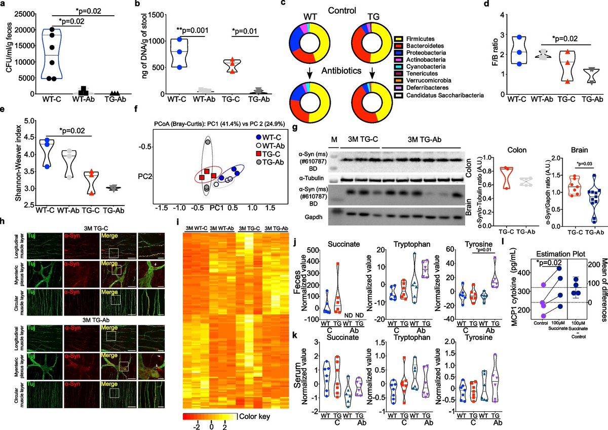 MolNeuro's tweet photo. 'Overexpression of human alpha-#synuclein leads to dysregulated #microbiome/metabolites with ageing in a rat model of #Parkinsons disease'

@ysinghbt...Olaf Riess, Nicolas Casadei @uni_tue

https://t.co/1Gk9CophTu https://t.co/wdTyH1ekff