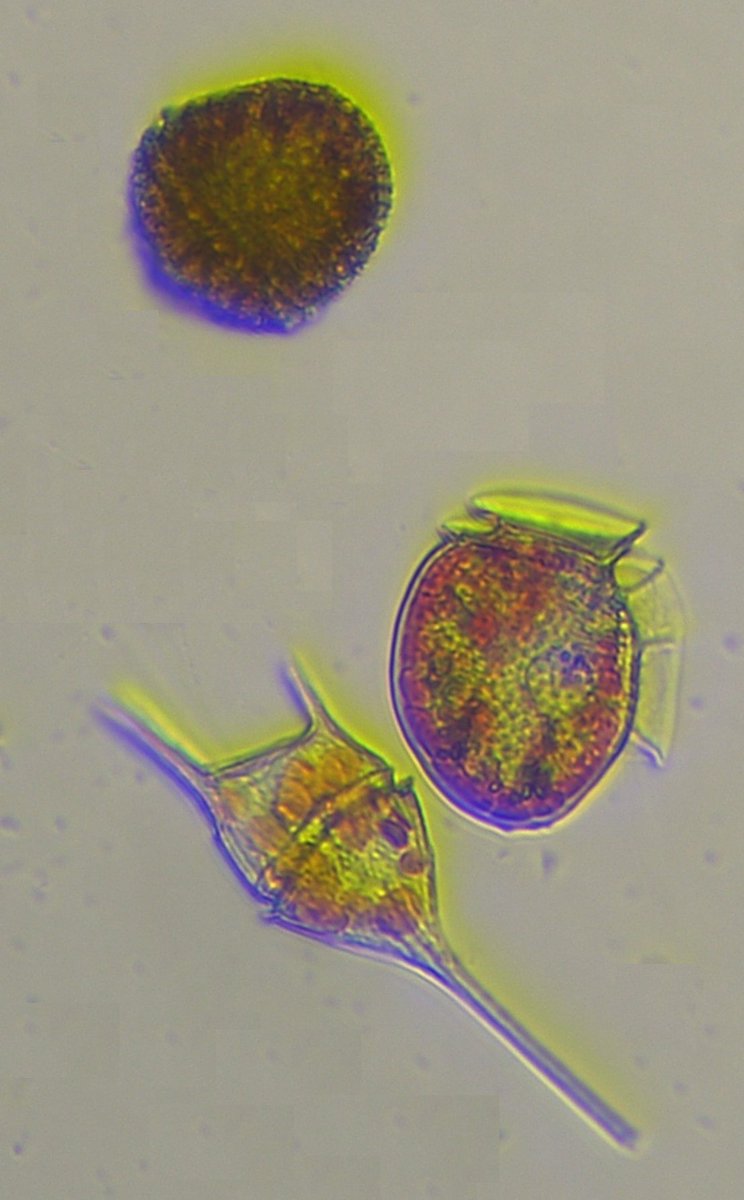plancton_andino's tweet photo. Nice image of 3 dinoflagellates species. using invert and background subtraction command with imageJ #ADICFITO PROJECT #POAS #DINOS #PSMB #AQUA #FANINDEX #FAN #HAB #FJORD https://t.co/GCtDkeoBrC